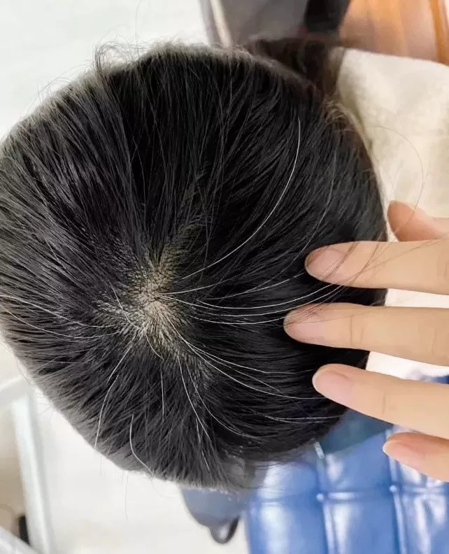 Before - visible grey strands at the crown